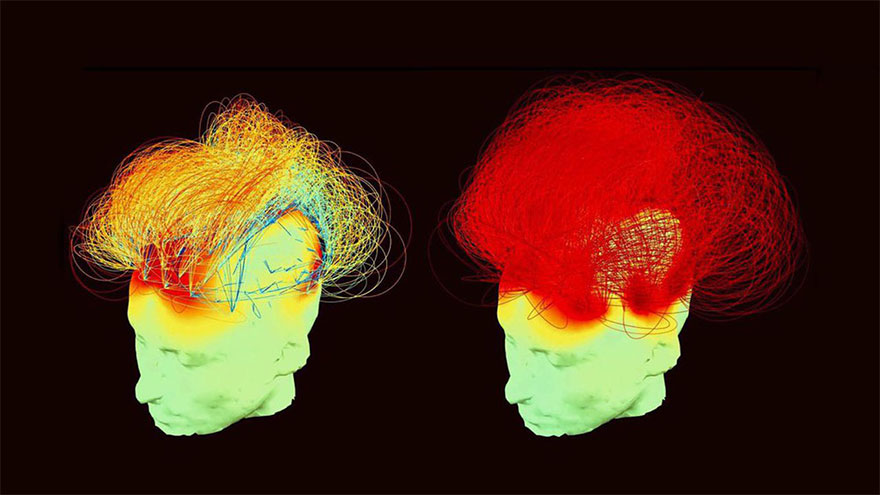 IRM en méditation